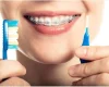 Orthodontic Innovations: Pioneering a New Era in Patient Comfort
