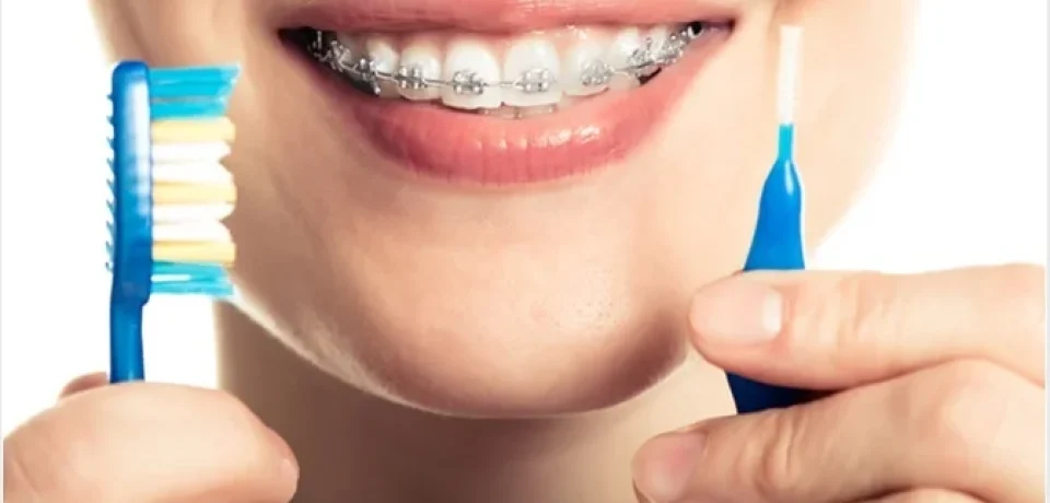 Orthodontic Innovations: Pioneering a New Era in Patient Comfort