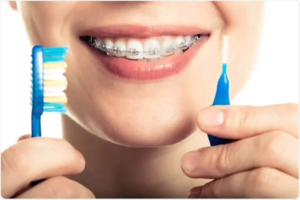 Orthodontic Innovations: Pioneering a New Era in Patient Comfort